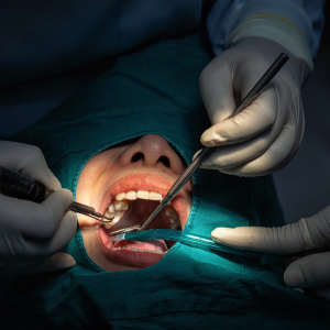 Oral Surgery